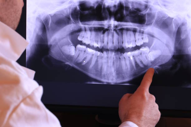 Professional Emergency Dental Service in CA