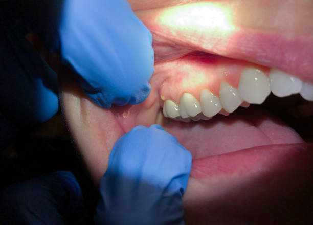 Best Emergency Orthodontic Repairs in Forest Ranch, CA